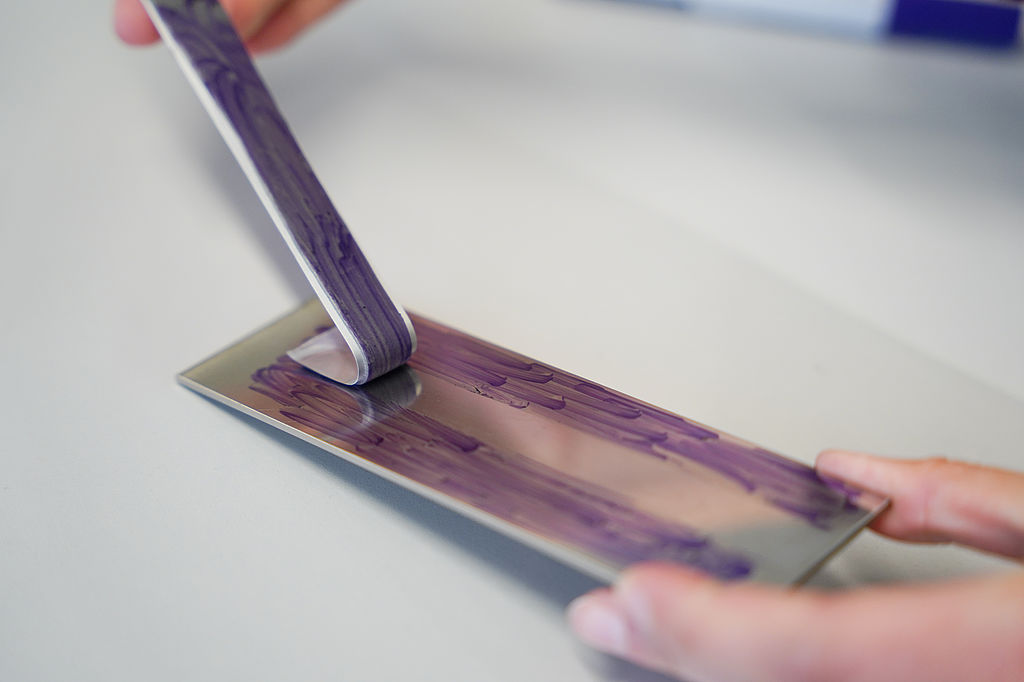 Schritt 6: Entfernen